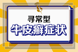 牛皮癣患者平常可以吃西瓜吗?对病情会有影响吗