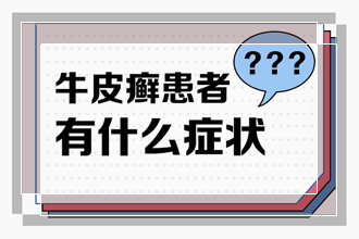 治疗银屑病花了一个月就 了太简单了