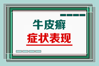 大家知道皮癣患者平时用什么洗澡对皮肤 好