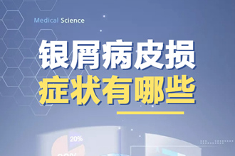 皮肤癣（银屑病）怎么治疗能 恢复？这些措施能帮助你防止病情反复