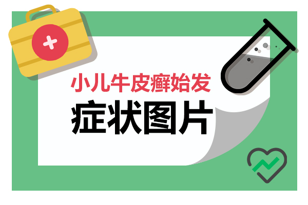 儿童银屑病的护理和治疗—医生这样说,家长 要知道.