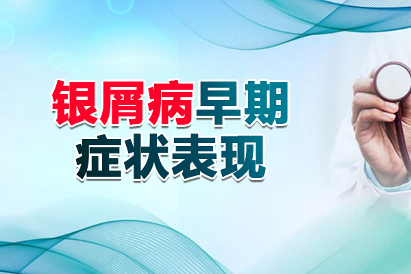 贵州治疗银屑病 好的医院-初期银屑病治疗要注意什么?