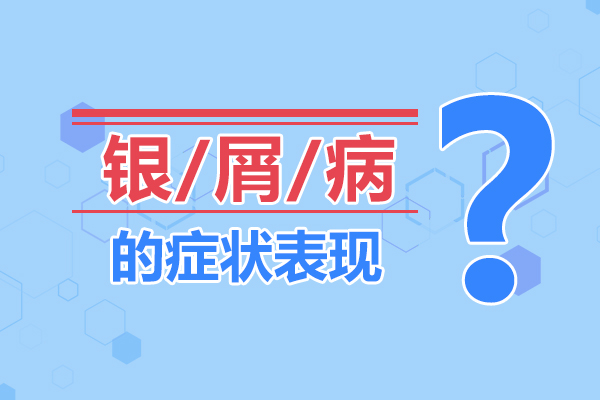 小小红斑会分型，学会分辨不盲目！牛皮癣有哪些不同的类型呢？