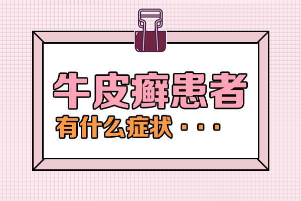 牛皮癣治疗不只“表面功夫”应该怎么做才能尽快告别牛皮癣呢？